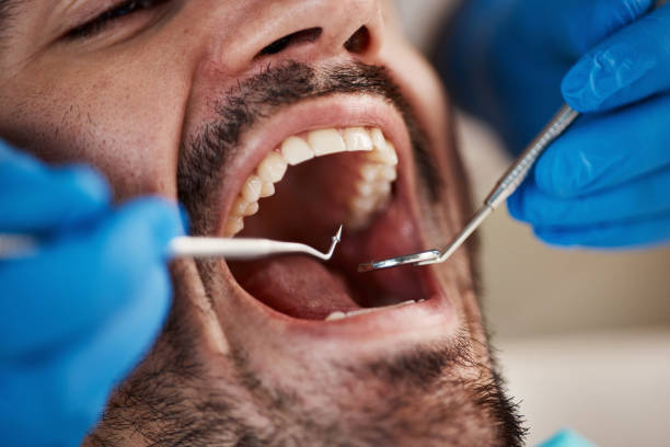 Best Emergency Wisdom Teeth Removal in Sunrise Manor, NV